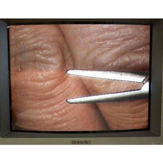 Used STORZ URBAN OPHTHALMIC OPERATING MICROSCOPE, FOOT CONTROLS FOR XY, ZOOM, FOCUS