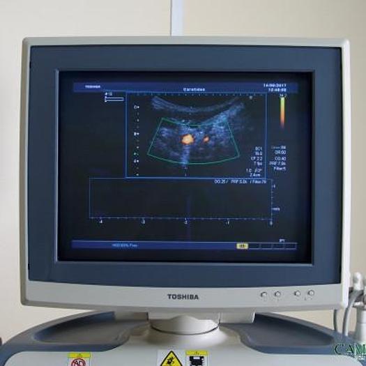 Used TOSHIBA XARIO ULTRASOUND SCANNER WITH 3 PROBES