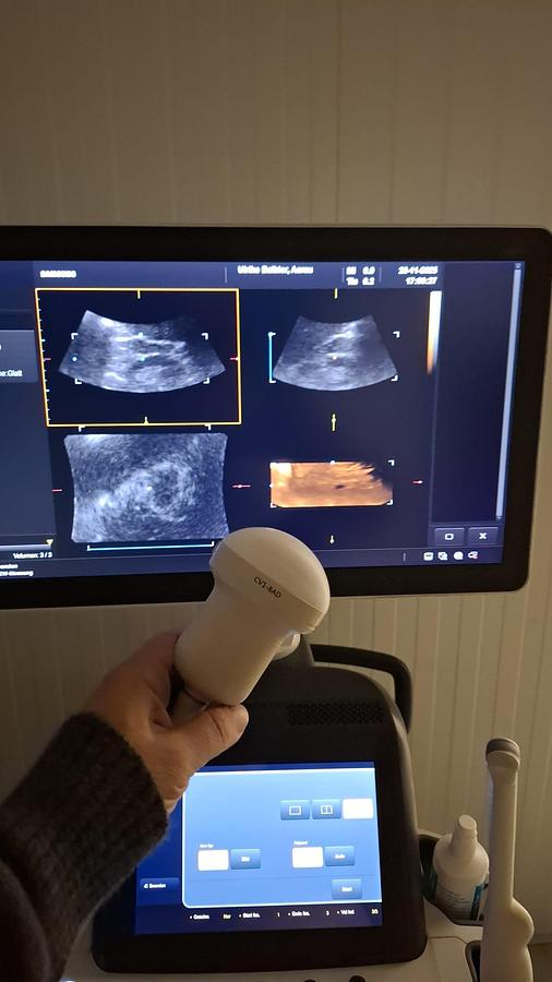 Rénové ECHOGRAPHE GYNECOLOGIQUE SAMSUNG H60