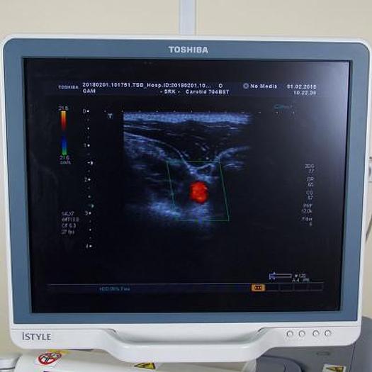 Used ULTRASOUND SCANNER TOSHIBA SSA 790A APLIO XG FLAT SCREEN WITH 3 PROBES