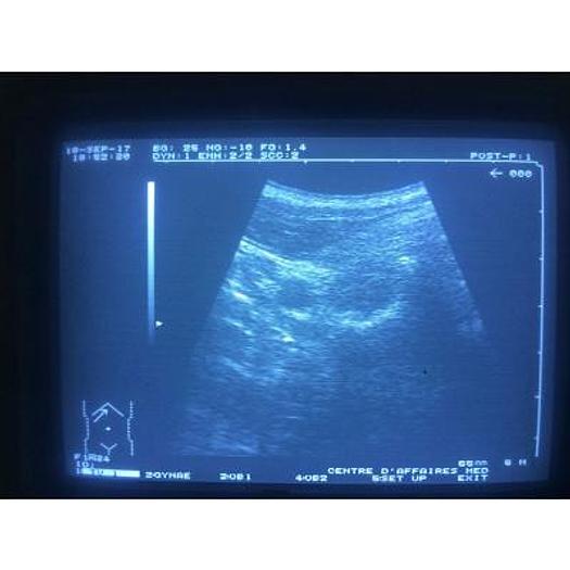 Used HITACHI EUP C324 5MHZ CONVEX PROBE