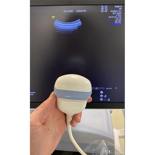 Used GENERAL ELECTRIC ECHOGRAPH Voluson E8 RSA BT19