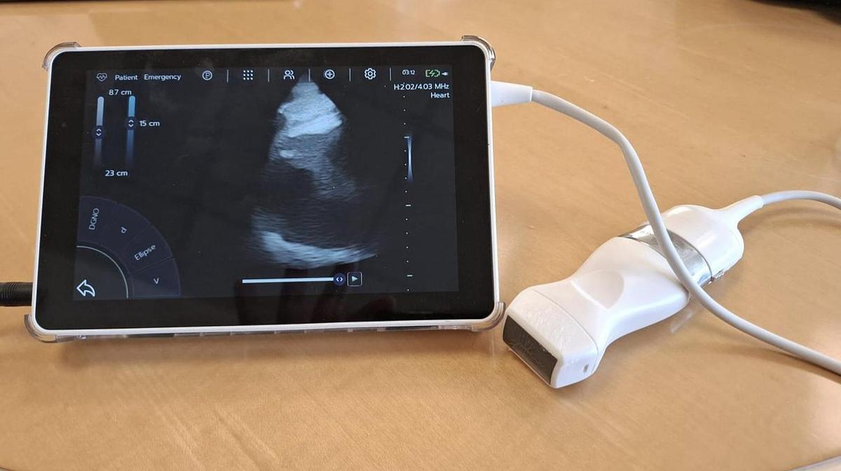 D'occasion ECHOGRAPHE SUPER PORTABLE SONOSCANNER U-LITE PRO AVEC 3 sondes interchangeables : convexe, lineaire, cardiaque