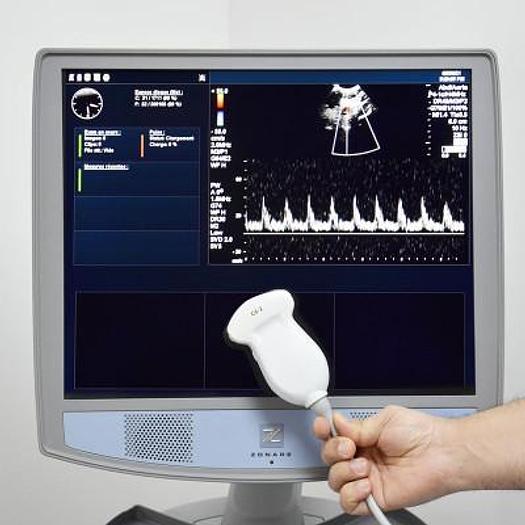 Used MINDRAY ZONARE ECHOCARDIOGRAPH