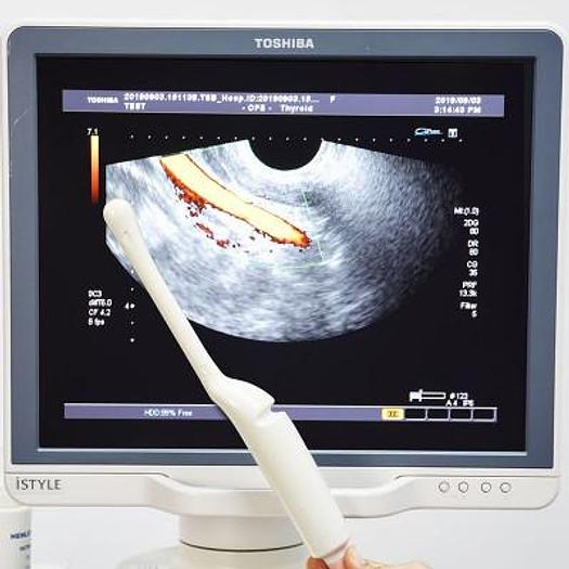 Used TOSHIBA APLIO XG ISTYLE ULTRASOUND WITH 6 PROBES INCLUDING 3D/4D AND FLAT SCREEN