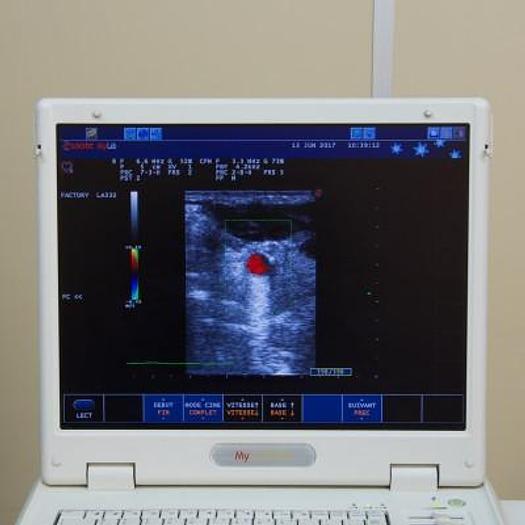 Used ESAOTE MYLAB 25 (2013) COLOR DOPPLER ECHOCARDIOGRAPH WITH 3 PROBES