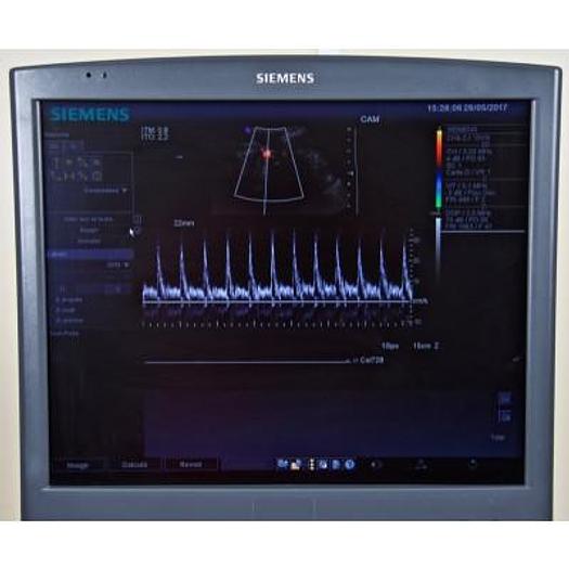 Used SIEMENS ANTARES 5.0 SONOLINE COLOR DOPPLER ULTRASOUND SCANNER