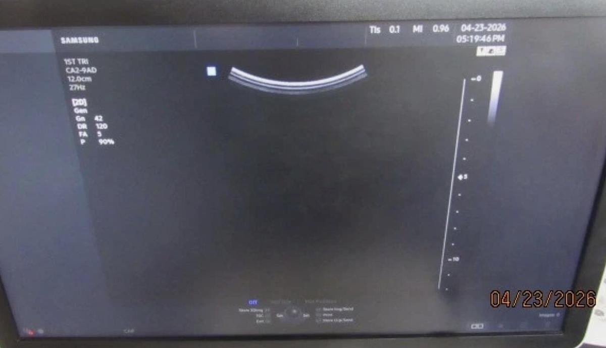 D'occasion SAMSUNG HS50 ULTRASOUND (11/2020)