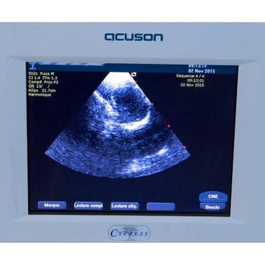 Used ACUSON SIEMENS CYPRESS COLOR PORTABLE ECHOCARDIOGRAPH WITH CART