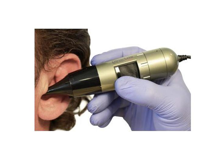 DIGITAL OTOSCOPE VIDEO OTOSCOPE EARSCOPE PRO, DINO-LITE