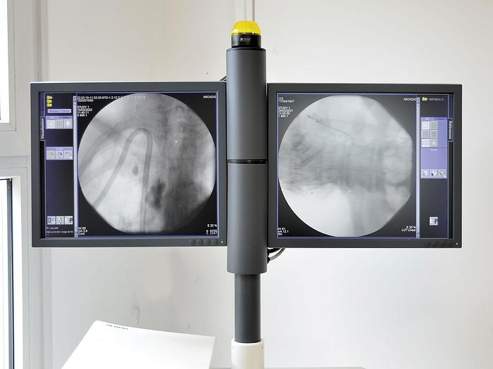 Used Siemens ARCADIS ORBIC - ORTHO and VASCULAR CINE+ image intensifier