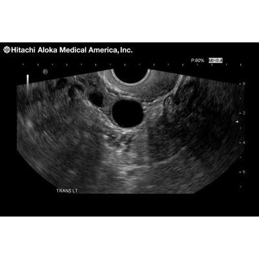 Used ALOKA/HITACHI PROSOUND 3500SX COLOR ULTRASOUND SCANNER