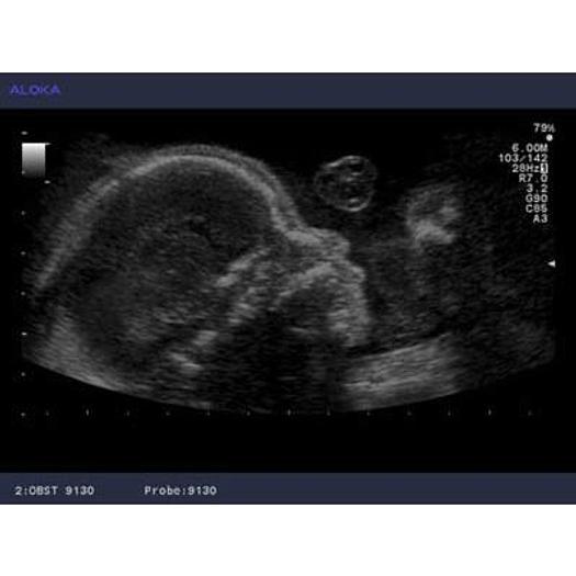 Used ALOKA SSD 4000 COLOR DOPPLER ULTRASOUND SCANNER