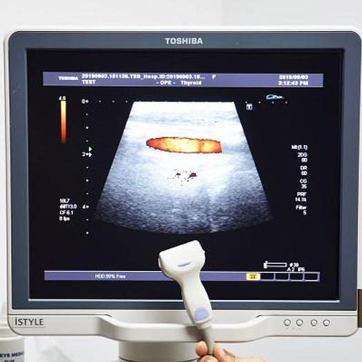 Used TOSHIBA APLIO XG ISTYLE ULTRASOUND WITH 6 PROBES INCLUDING 3D/4D AND FLAT SCREEN