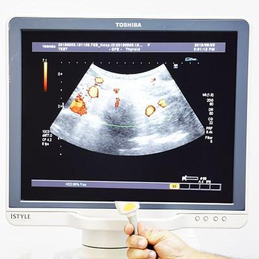 Used TOSHIBA APLIO XG ISTYLE ULTRASOUND WITH 6 PROBES INCLUDING 3D/4D AND FLAT SCREEN