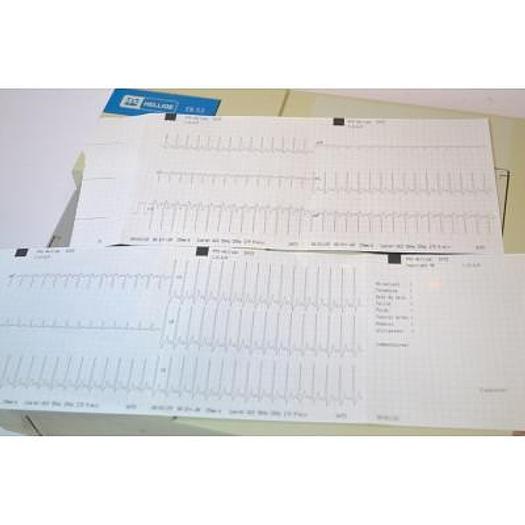 Used HELLIGE CARDIOTEST EK53 ELECTROCARDIOGRAPH