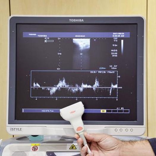 Used TOSHIBA Xario XG ultrasound scanner (SSA-680A)