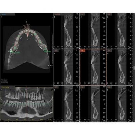 Used VATECH PAX I 3D SMART DENTAL PANORAMIC with CEPHALOSTAT (Panorama + Cephalo Scan Shot + CBCT)