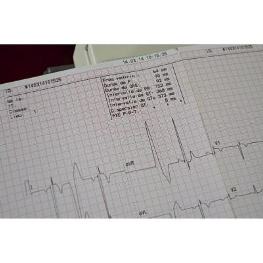 Used ECG SIEMENS BURDICK ECLIPSE 850 12 TRACKS ON CART