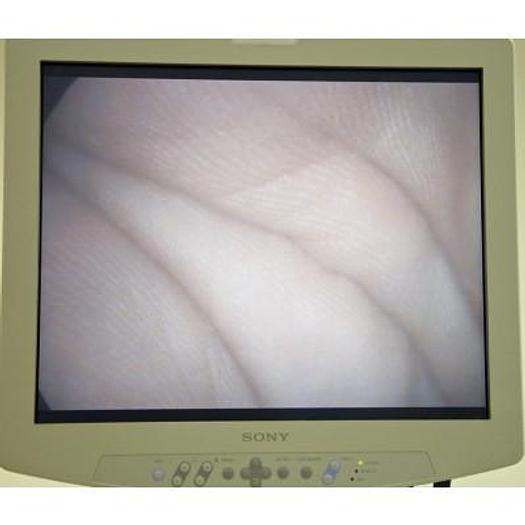 Used SOPRO 169 ENDOSCOPY COLUMN WITH 3CCD DIGITAL CAMERA
