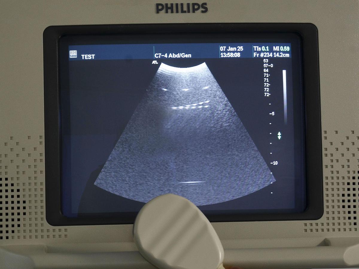 original-d-occasion-echographe-philips-hdi-5000.JPG