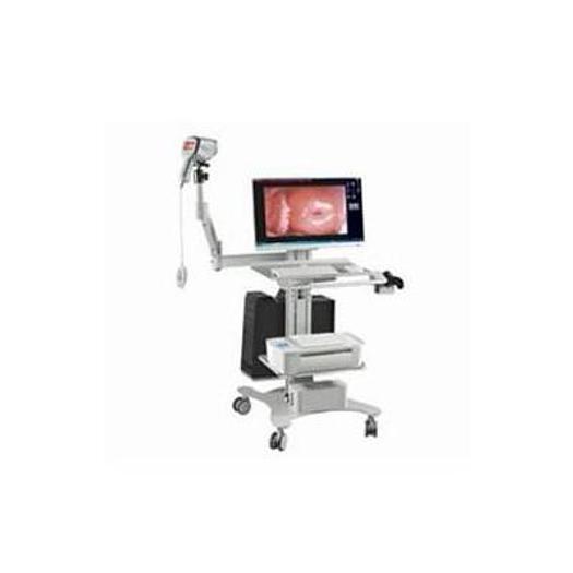 VIDEO COLPOSCOPE TOVAMED GYSCOPE