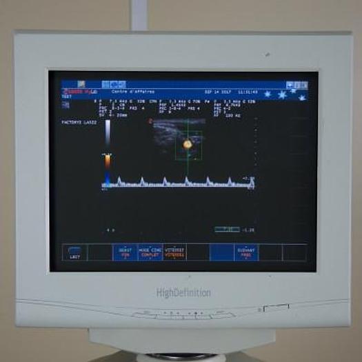 Used ESAOTE MYLAB 50 VASCULAR ULTRASOUND SCANNER WITH 2 PROBES
