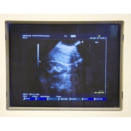 Used HITACHI PLATFORM ELITE DIGITAL COLOR DOPPLER ULTRASOUND WITH 3 PROBES