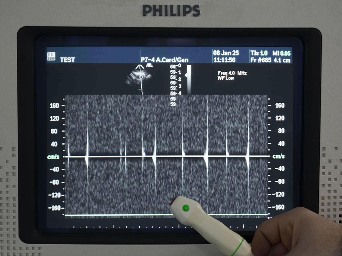 original-d-occasion-echographe-philips-hdi-5000.jpg