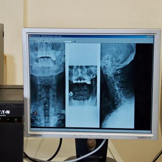 Used KODAK DIRECTVIEW CR500 DIGITIZING SYSTEM WITH PROCESSING CONSOLE AND REPROGRAPHER