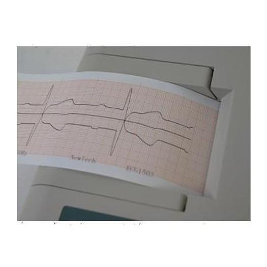 Used NEWTECH 1503 AV INTERPRETATION 3-CHANNEL ELECTROCARDIOGRAPH