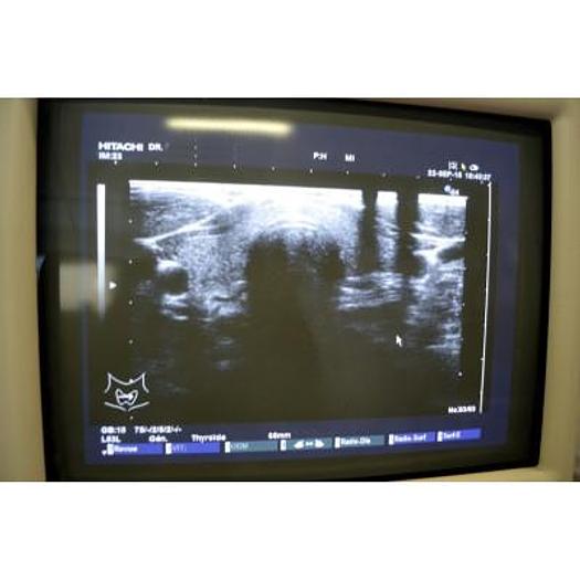 Used HITACHI EUB 6500 PLATFORM ELITE COLOR ULTRASOUND SCANNER WITH 4 PROBES