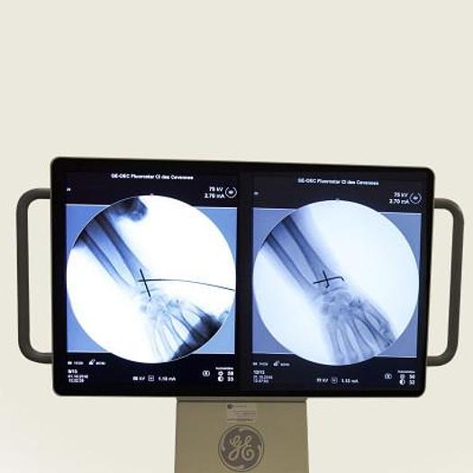 Used BRILLIANCE AMPLIFIER (04/2018) GENERAL ELECTRIC FLUOROSTAR for general and vascular applications