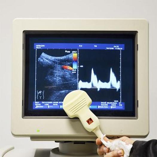 Used HITACHI EUB-5500 ULTRASOUND SCANNER