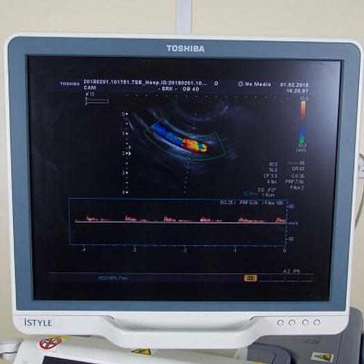 Used ULTRASOUND SCANNER TOSHIBA SSA 790A APLIO XG FLAT SCREEN WITH 3 PROBES