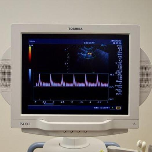 Used TOSHIBA NEMIO XG COLOR DOPPLER ULTRASOUND SCANNER WITH FLAT SCREEN AND 2 PROBES