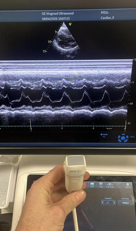 D'occasion GE CARDIAC ULTRASOUND VIVID T8