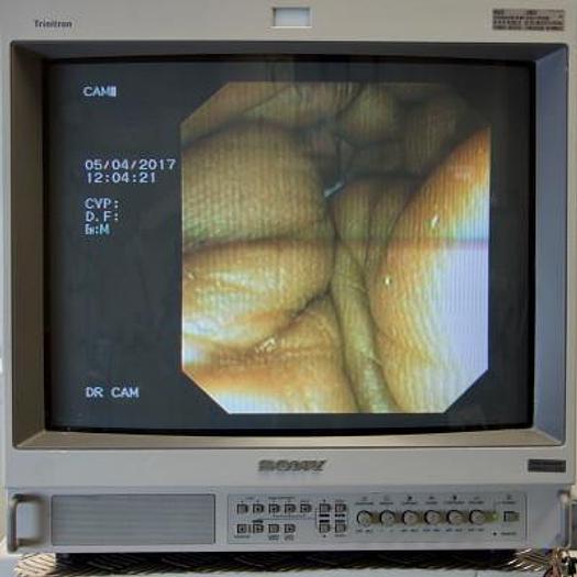 Used OLYMPUS DIGESTIVE ENDOSCOPY COLUMN WITH VIDEOCOLONOSCOPE AND VIDEOGASTROSCOPE