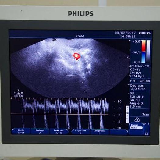 Used PHILIPS HD 7 XE COLOR DOPPLER ULTRASOUND WITH 3 PROBES