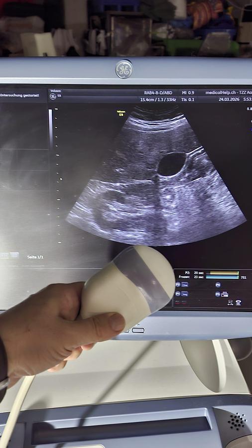 D'occasion GE VOLUSON E8 ULTRASOUND 