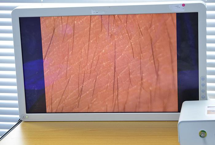 D'occasion COLPOSCOPE ZEISS KSK 150 FC