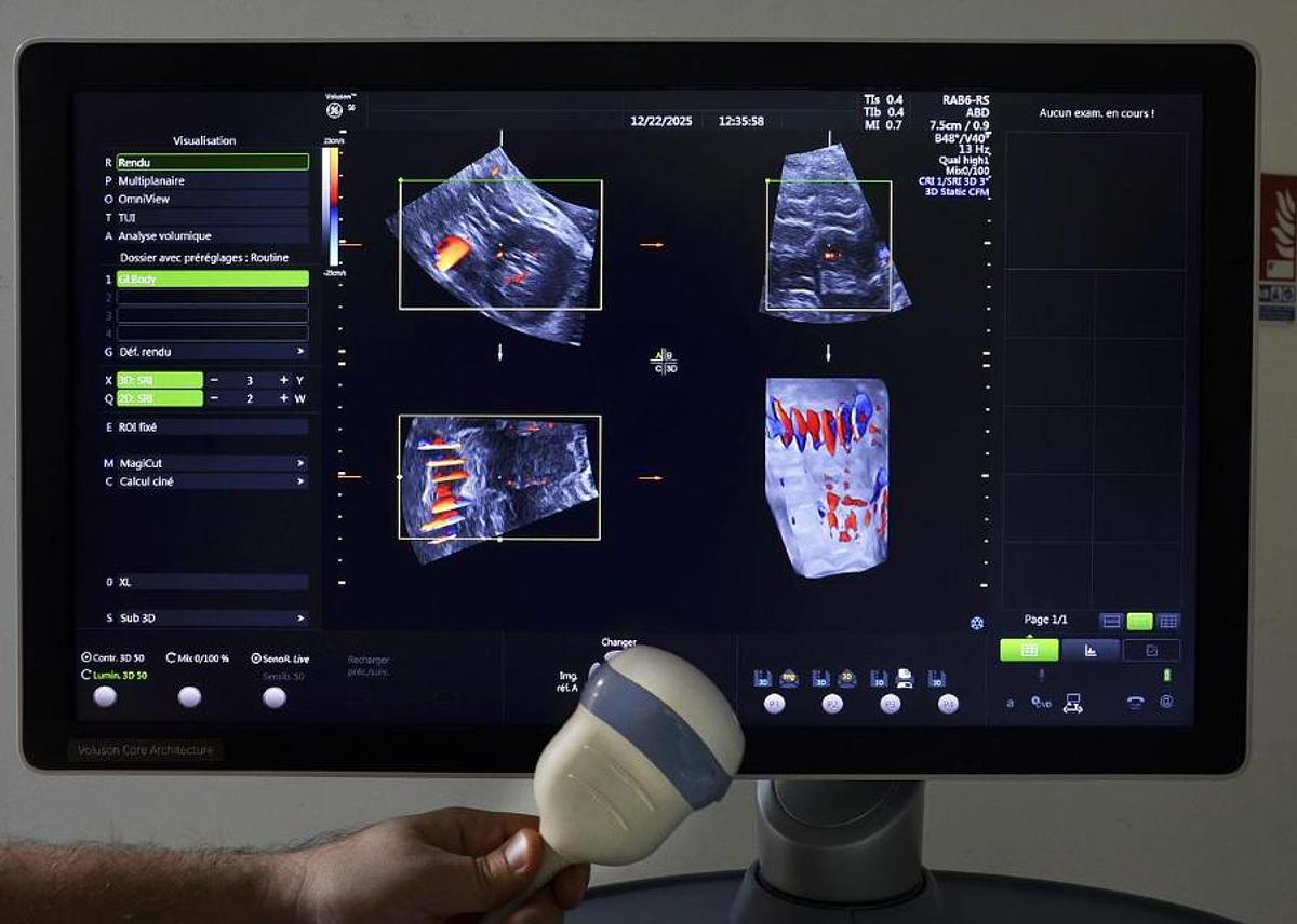 D'occasion GENEAL ELECTRIC VOLUSON S6 ULTRASOUND UNIT