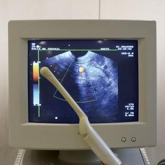 Used TOSHIBA ECCOSEE SSA-340A ULTRASOUND SCANNER