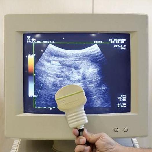 Used TOSHIBA ECCOSEE SSA-340A ULTRASOUND SCANNER