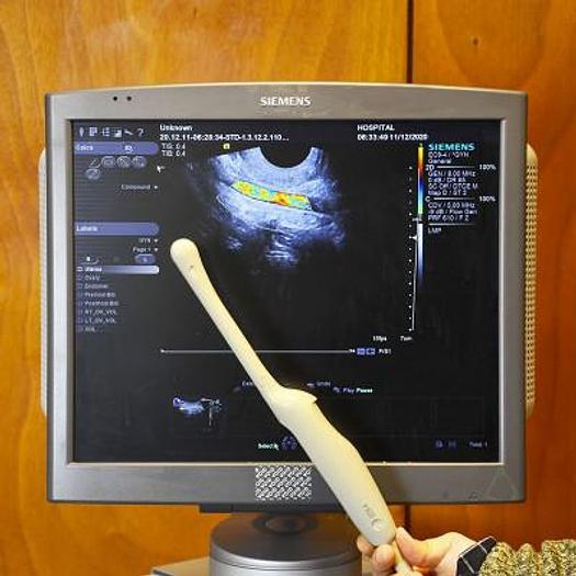 Used SIEMENS ACUSON S1000 ULTRASOUND SCANNER