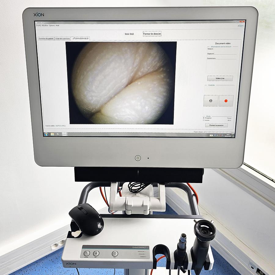 D'occasion XION ENDO COMPACT FULL HD COMPACT ENDOSCOPY COLUMN