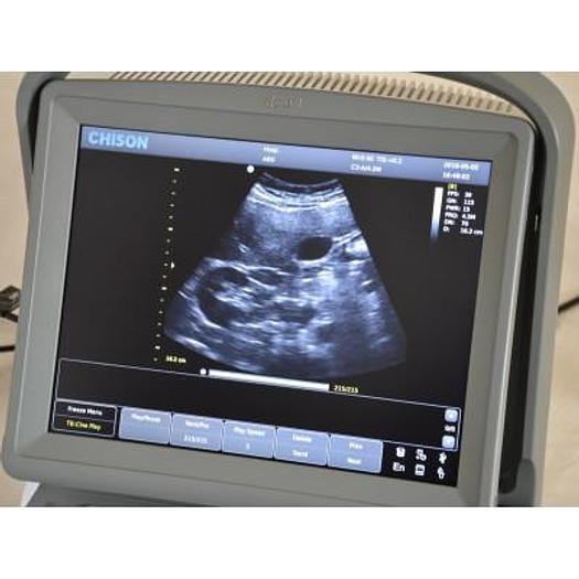 CHISON ECO1 PORTABLE ULTRASOUND WITH ABDOMINAL PROBE