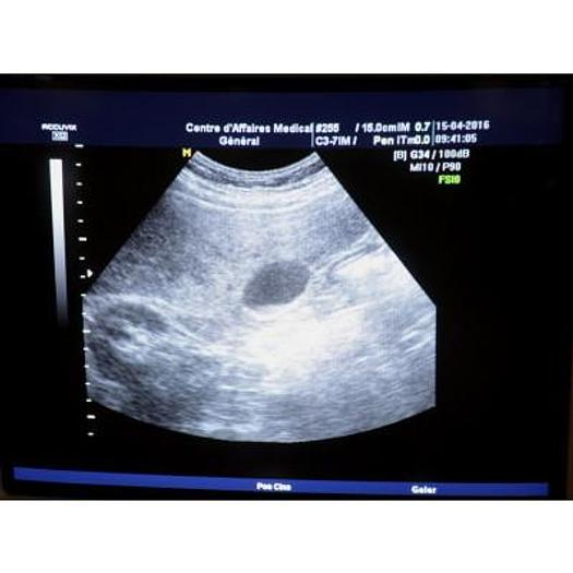 Used ACCUVIX XQ 3D/4D ULTRASOUND SCANNER WITH 4 PROBES