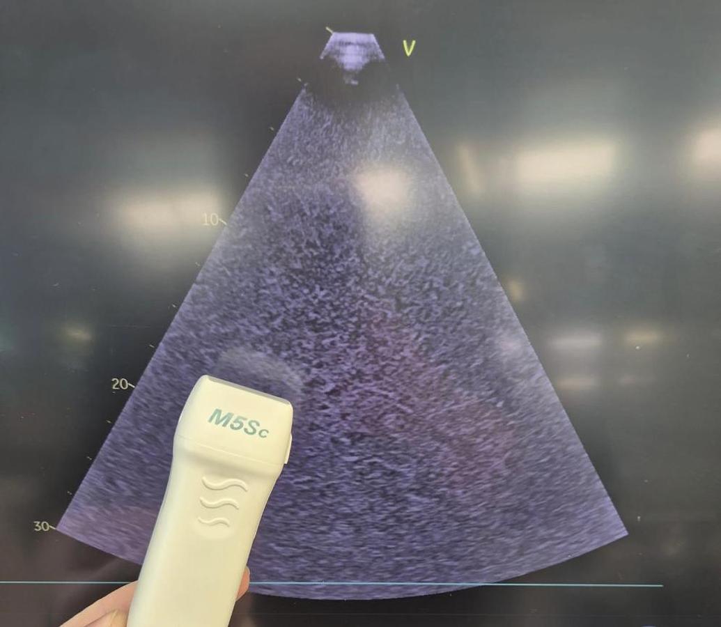 D'occasion GE CARDIAC ULTRASOUND VIVID T8