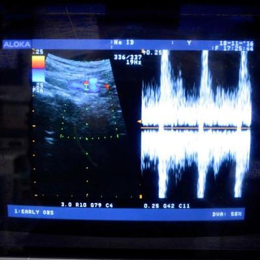 Used ALOKA SSD 4000 COLOR DOPPLER ULTRASOUND SCANNER WITH 2 PROBES